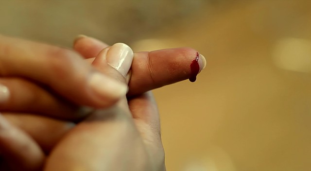 İncir Reçeli Fotoğrafı