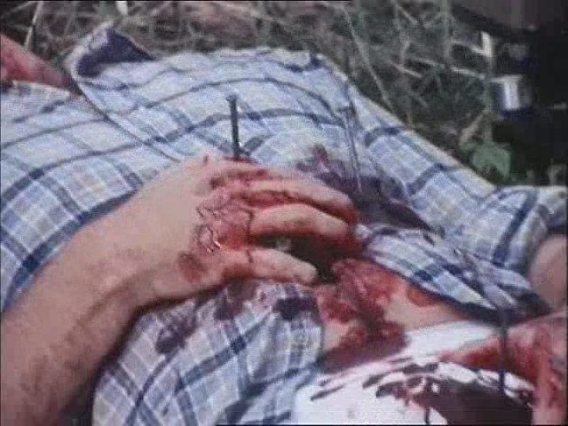 Çivili Silah Katliamı Fotoğrafı