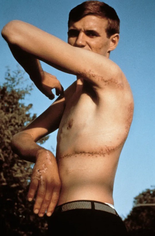 Rodney Fox fotoğrafı