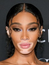 Winnie Harlow fotoğrafı