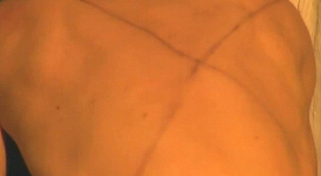 Dabbe Fotoğrafı